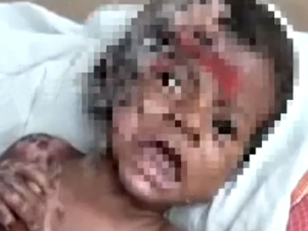 TN’s self combusting baby actually a victim of domestic abuse? TN’s self combusting baby actually a victim of domestic abuse?