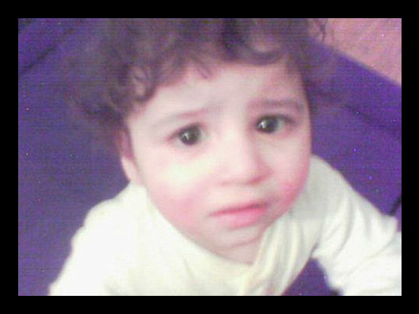 ஊட்டச்சத்து குறைபாடு....