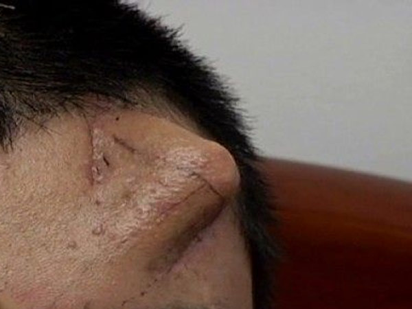 ஸ்டெம்செல்தெரபி....