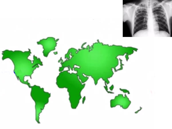 உலக அளவில்