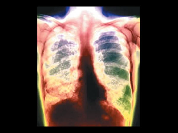 5 நாடுகள்