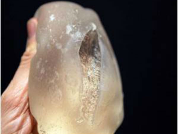 தரம் குறைந்த செயற்கை மார்பகங்கள்....