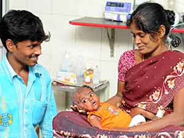 திடீர் திடீரென தீ்ப்பிடித்து எரிந்த குழந்தை