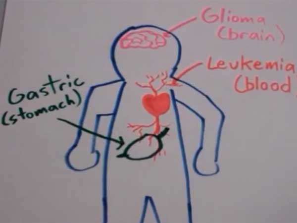 உலகப் பிரச்சினை