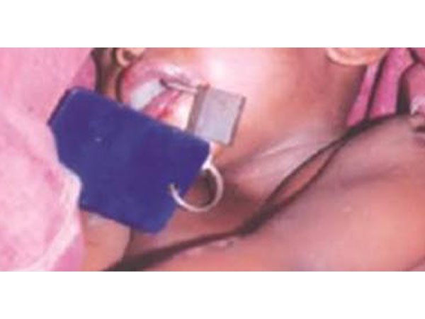 Nigeria father locks his own son’s mouth