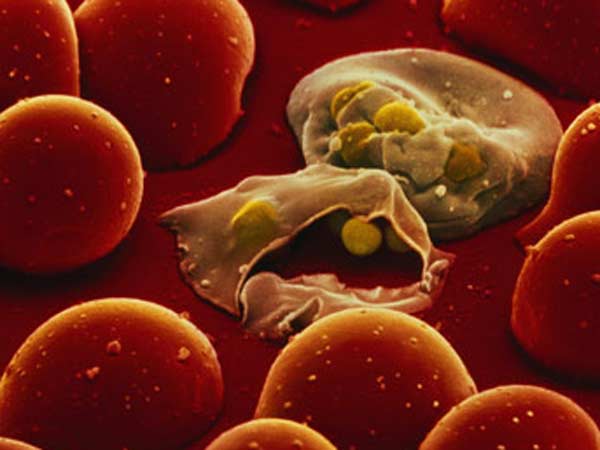 பரவும் மலேரியா