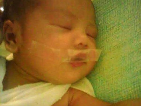 டேப்பை அகற்ற மறுப்பு..