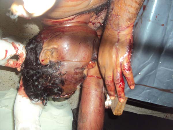 AIADMK MLA critical after attack