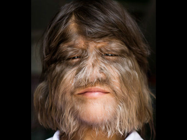 முகம் முழுவதும் முடி... முகம் முழுவதும் முடி...