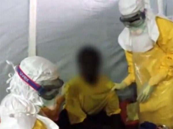 எபோலா வைரஸ் அறிகுறிகள்