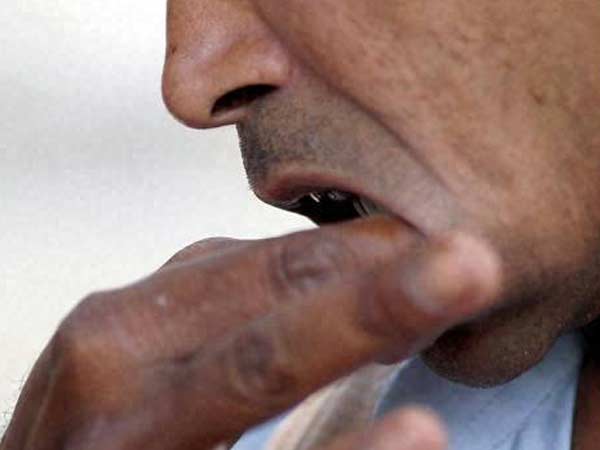 வாய்ப்புற்று...