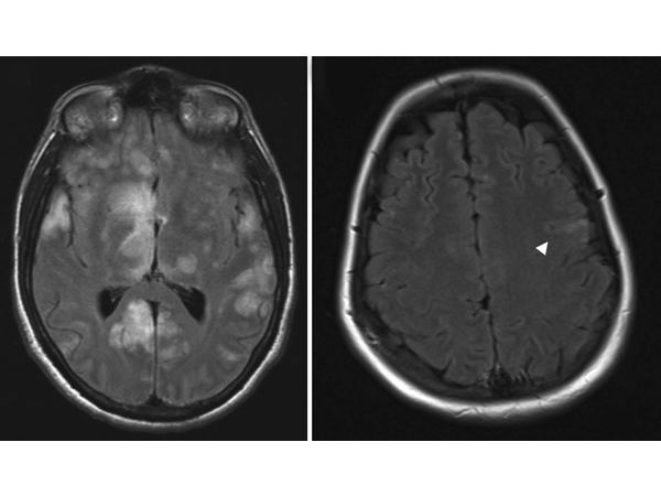 மத்திய அரசு நடவடிக்கை 