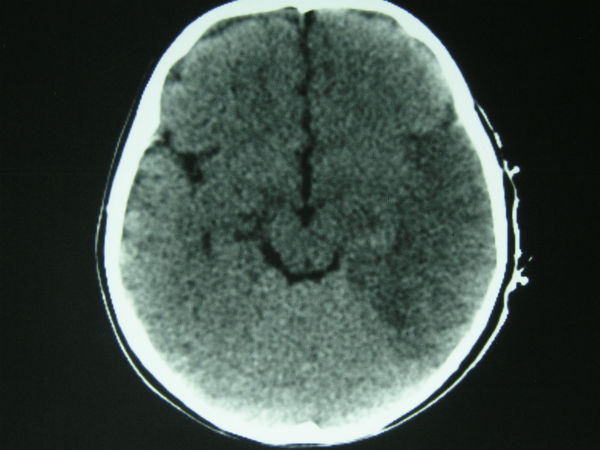 60 பேர் பலி