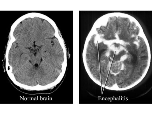 உத்தரபிரதேசத்தில் தாக்குதல்