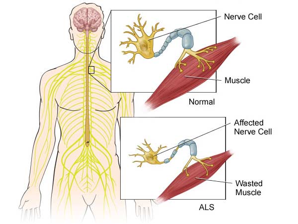 லட்சத்தில் இருவர்