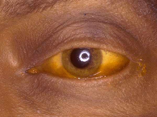 பாதிக்கப்பட்டவர்கள்...