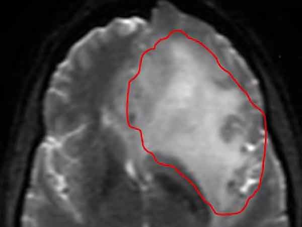 உயிரை பறிக்க அவசரமா....?