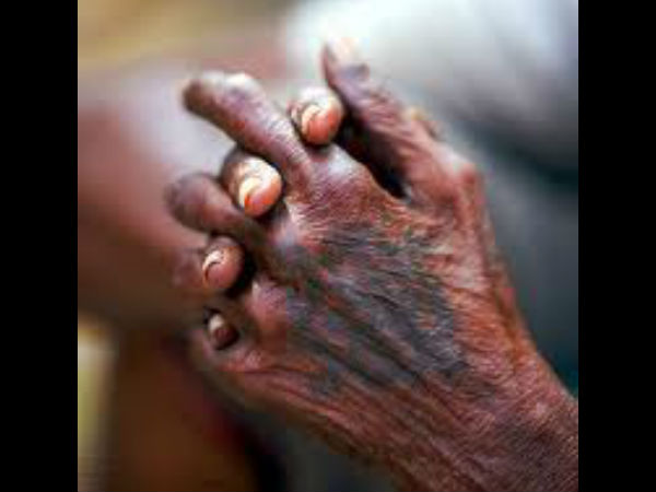 90 வயதைக் கடந்தவர்கள்: