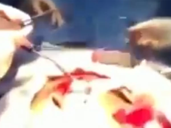 அனுமதி இல்லாமல் பதிவேற்றம்: