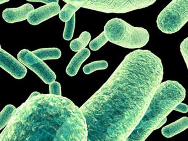 நிலத்தடி விடுதி அமைப்பு: