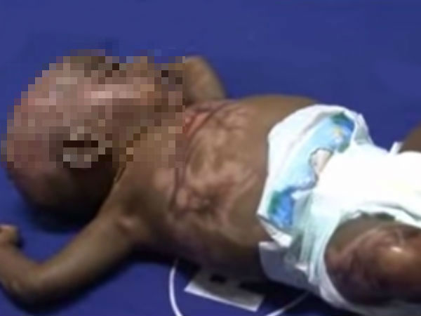 முதல் தீக்குழந்தை ராகுல்