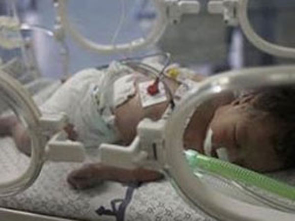 3வது குழந்தைக்கும் அதே பிரச்சினை