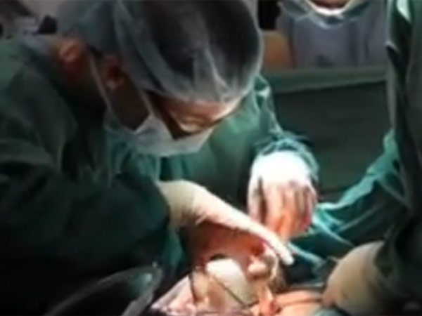 ஆபத்தான ஆபரேஷன்...