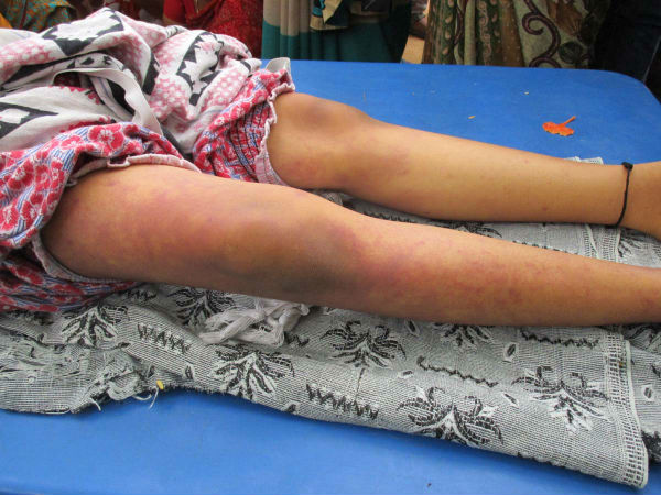 9-year old girl dies after facing punishment in school; parents vandalize school premises