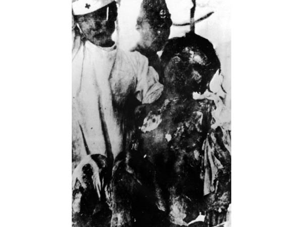 When 'little boy' showed his cruel face to the mankind