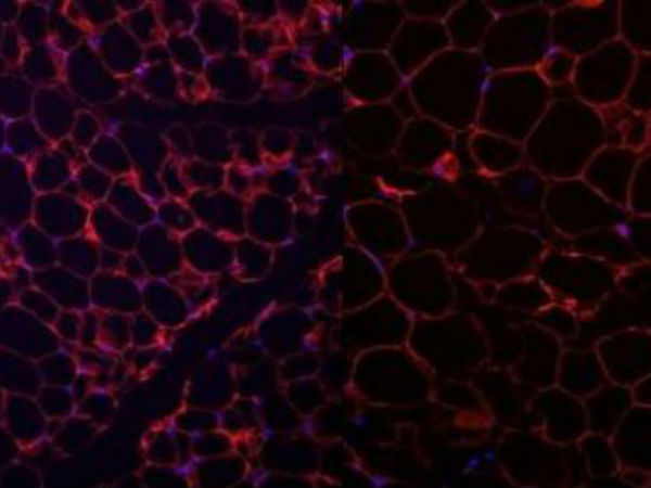 மரபணு கண்டுபிடிப்பு...