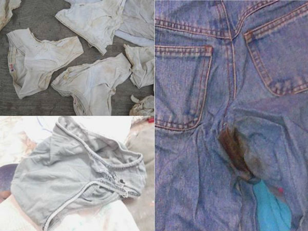 கிழிசல், கறைகள்