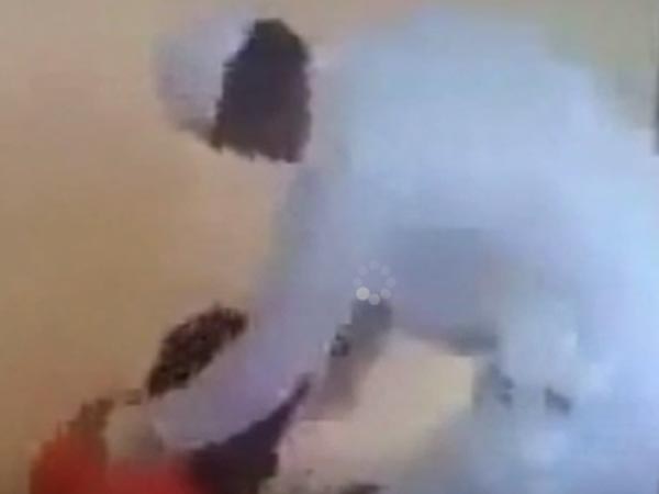 கண்களில் ரத்தம் வருகிறது...