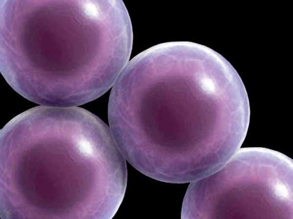 அறுவை சிகிச்சை செல்கள்: