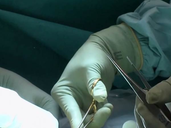 மூளைச்சாவு...