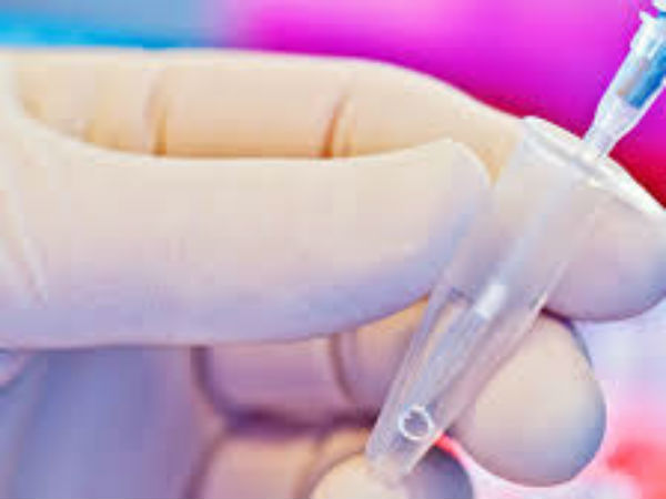 அமில உருவாக்கம்... அமில உருவாக்கம்...