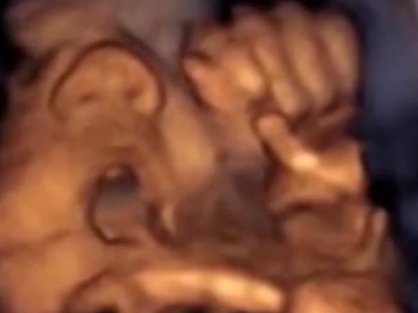 பேபிபாட்...