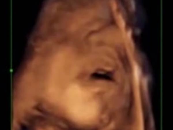 இரட்டைக் குழந்தைகளும்...