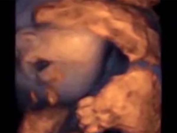 சிறப்பு ஸ்பீக்கர்கள்...