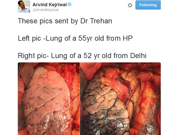 வைரல் ஆனது