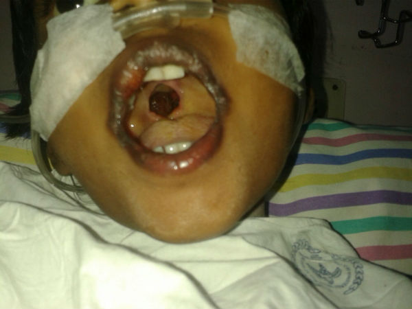 Dear readers, a 5-year old kid is in need of your help