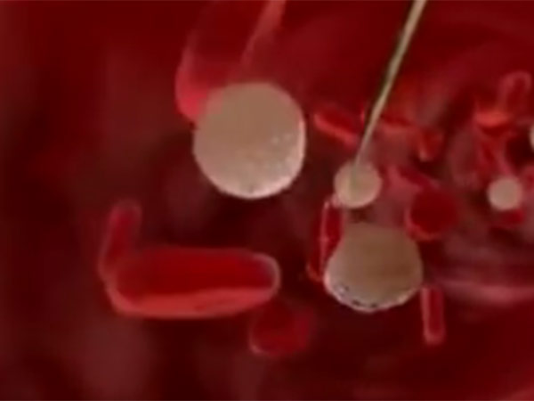 4000 ஆயிரம் குழந்தைகள்: