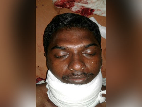 ராம்குமாருக்கு ஆதரவாக பேச வந்தவரா?