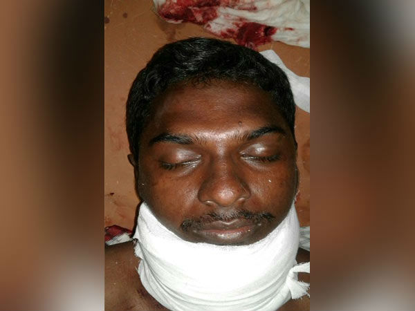 போலீசார் அறுத்ததாக புகார்