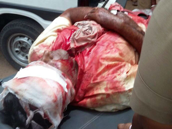 Son knifes lawyer father on Madras High Court premises