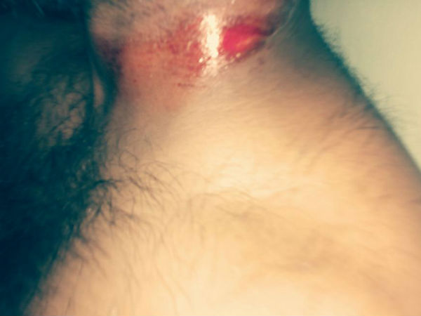 எனது உடலில் காயங்கள் 