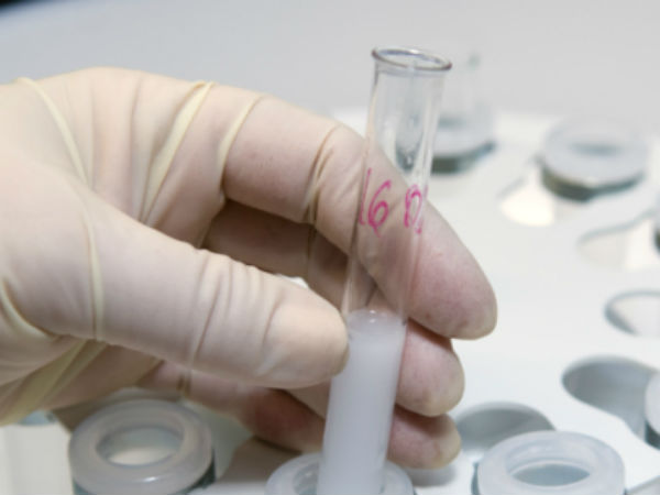 எருமையின் விந்தணு