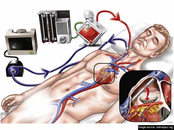 முக்கிய நரம்பில் இரட்டை துளை