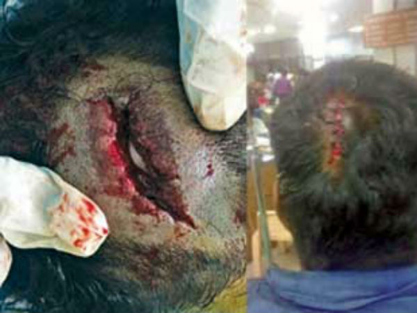 Chennai Cops brutally assaulting left protesters