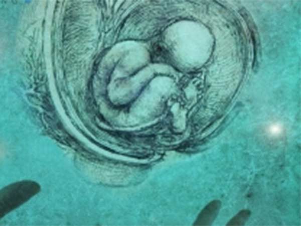 பலமுறை கருக்கலைப்பு