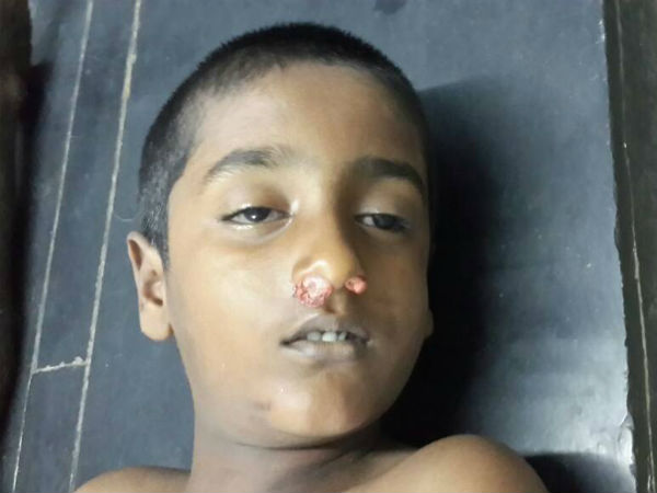 சிறுவன் மரணம்